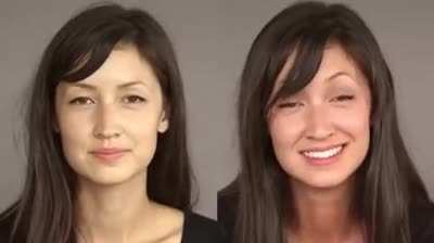 Alcohol flush reaction , Also known as 
