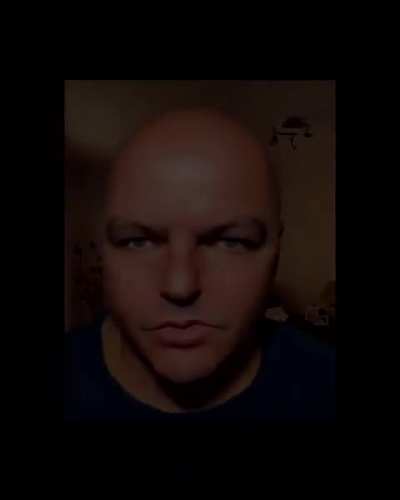 the lobotomy