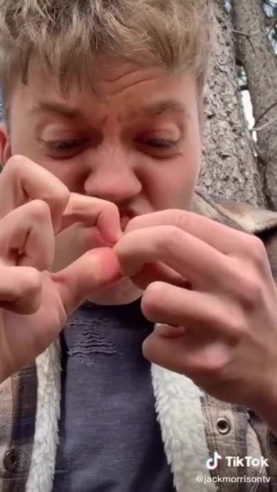 Pistachios.