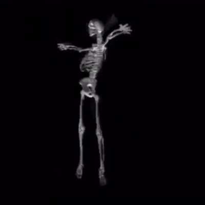 Skeleton