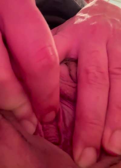 Strange, fleshy mass protruding from vagina