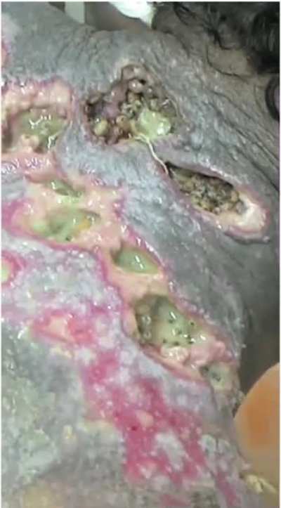 You’re an ER doctor and a patient came in with this situation. Wdyd?