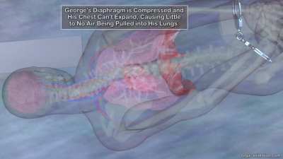 George Floyd Animation - I created an animation of the Police Brutality that led to George's Death. It also shows the mechanism of death that is described by the family autopsy.