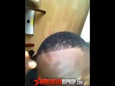 Man's hairline