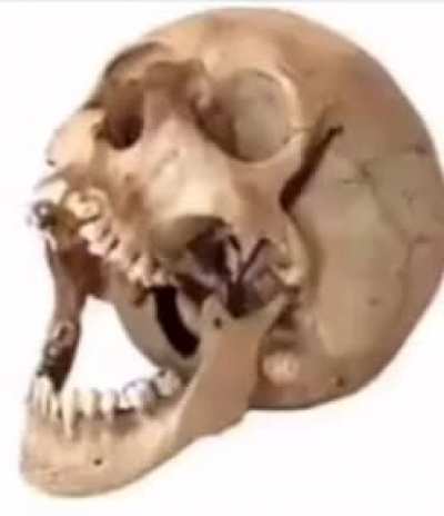 💀💀