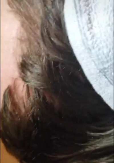 My ears itchy