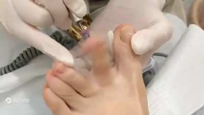 Toast to the Toe