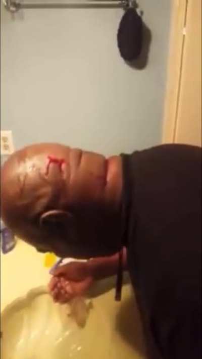 Cheap razors/rubbing alcohol… You missed a spot