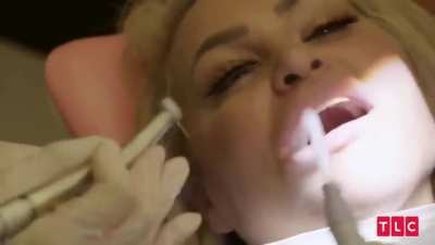 90 Day Yuck Mouth!
