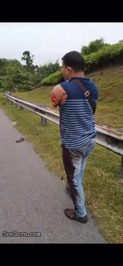 Biker lost his arm, but still standing strong