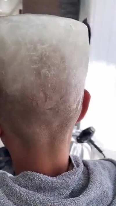 Brain freeze