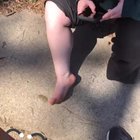 My sister got a splinter today.