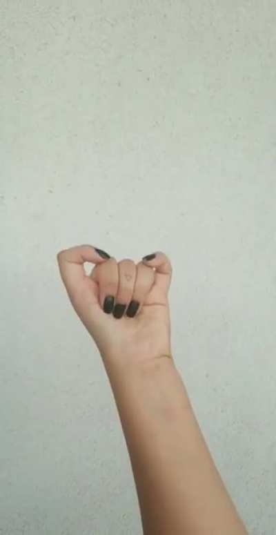 Triphalangeal thumb