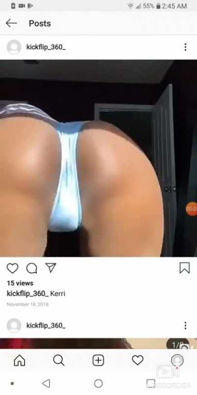Cheeks