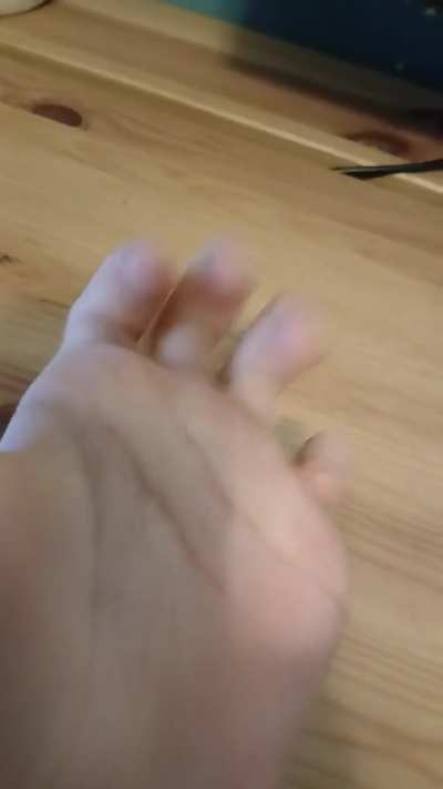 So apparently not everyone can do this???