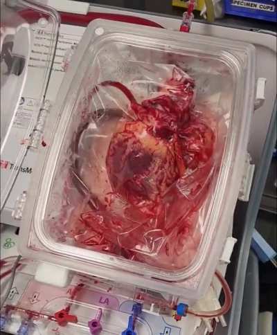 Having the ability now to keep an organ alive outside of the body for transplant. I love this job. 
