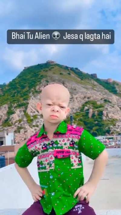 👽👽