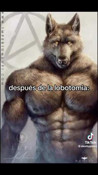 Lobotomia