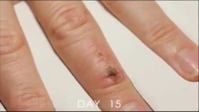 Timelapse of a wound healing (28 days)