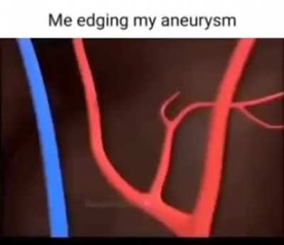 Me when