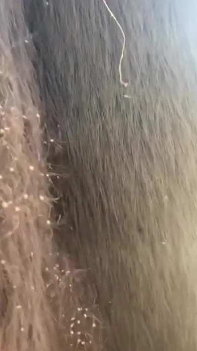 Hairy Trees