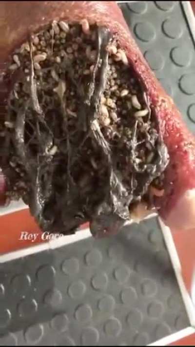Infected foot