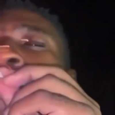 Man burned his face