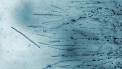 Mycelium growth under the microscope