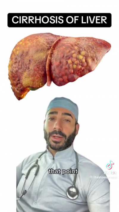 Increase in Young Liver Failure