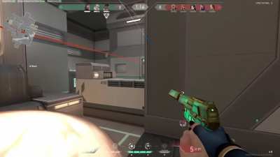 ITS THE LAG