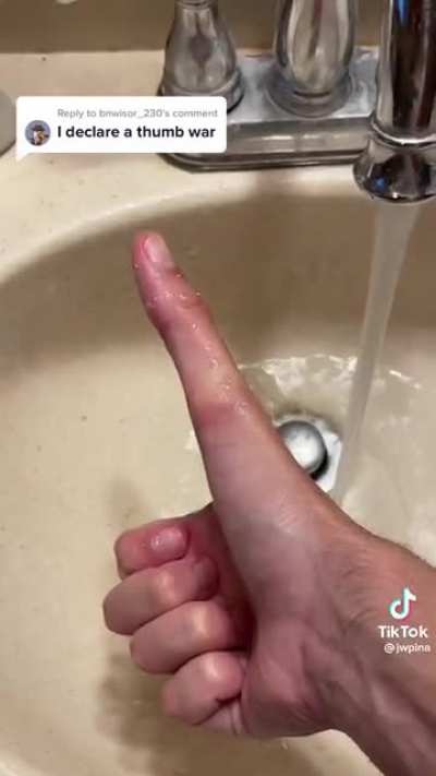 Thanks, I hate this Thumb War