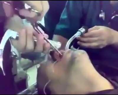 Damm it, I told you not to put it in there