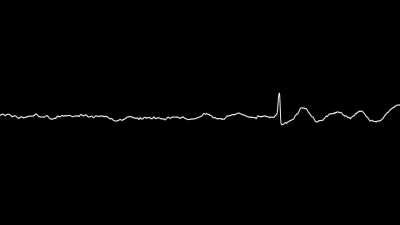 I put Jerma's teacher noise through the Commodore 64's sound chip filter