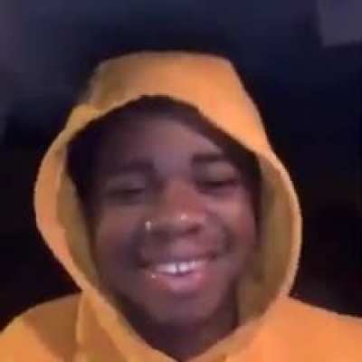 aux 😳