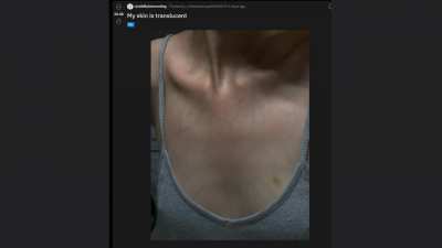Pinos Real