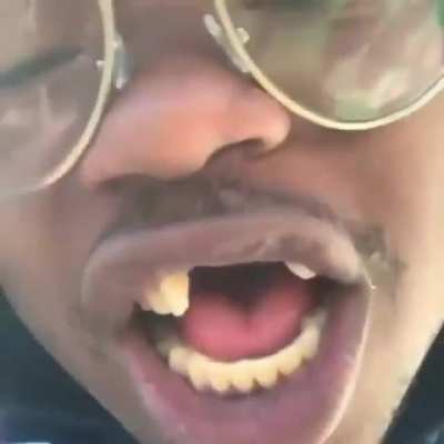🦷——————🦷