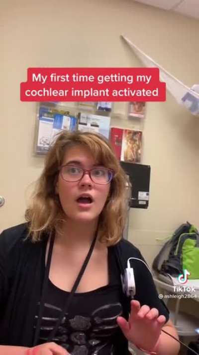 First time getting cochlear implant activated