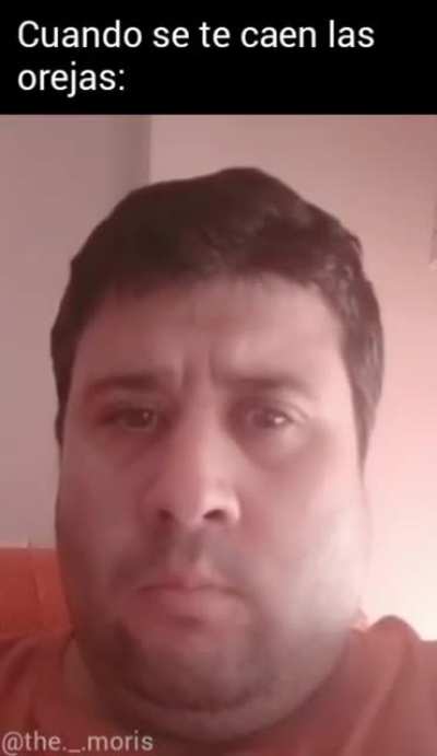 Xd