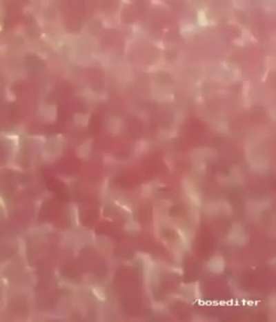 İnsan derisine zoom yapılmasıyla ortaya çıkan görüntüler: