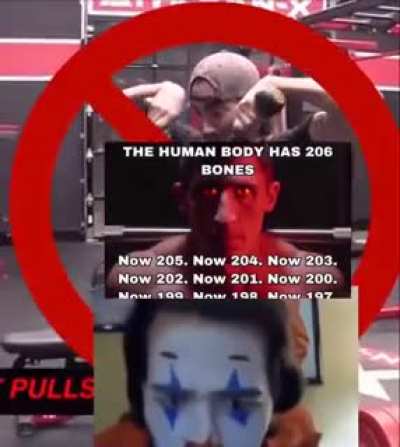 Go ahead retard laugh.