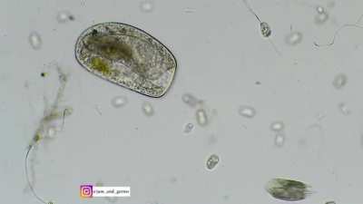 Bursaria truncatella going on a rampage and swallowing everything it can