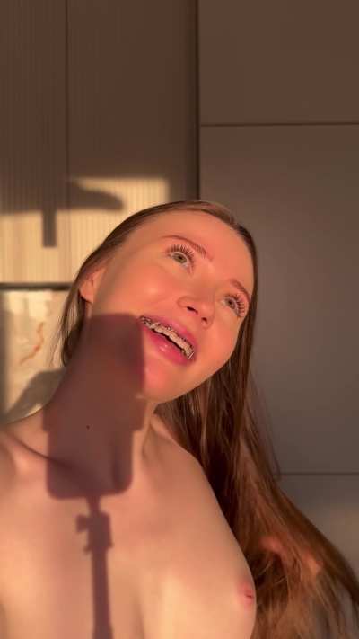Do you like my smile with braces?