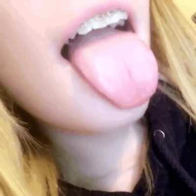 Only a little more karma until I can post slideshows of all my braces triggers - you wouldn't want that to happen, would you?