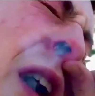 Lighting weed inside nostril