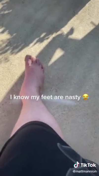 I know my feet are nasty.