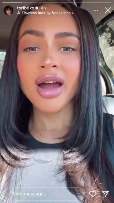 Those lips