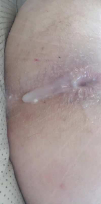 Anal Creampie dripping out with a gape from BBC🍑💦<wbr>💦