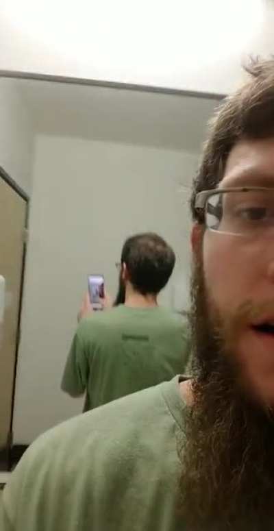 I noticed my hair loss for the first time today