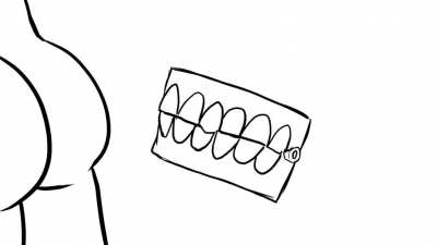The famous chattering teeth