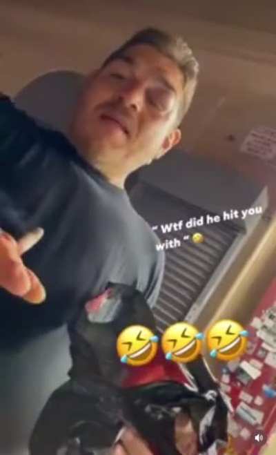 😳